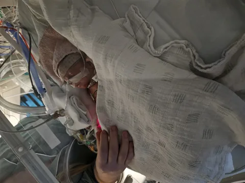 Senne op de neonatale afdeling, met een hand van mama of papa bij hem.